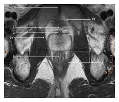 3t mr anatomy of the prostate gland