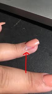 hit my acrylic nail resulting in