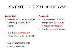 Ventricular Septal Defect Vsd Ppt Video Online Download