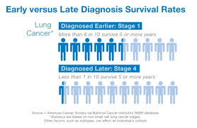 Stage 4 lung cancer has no set course. St Elizabeth Healthcare Lung Cancer Surgery