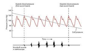 Blood Flow Blood Pressure And Resistance Anatomy And