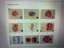 Check spelling or type a new query. The Image Below Are Of Cells In Mitosis That You Chegg Com