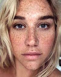 her freckles in fresh faced selfie