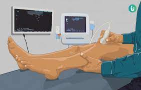 color doppler ultrasound procedure
