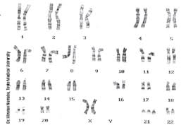We did not find results for: Solved Given The Karyotype Shown At Right Is This A Male Or A Fe Chegg Com