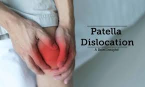 nail patella syndrome tips advice