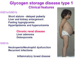 von gierke disease causes symptoms