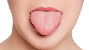 numb tongue is it a sign of a stroke