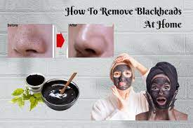 diy blackhead remover how to remove