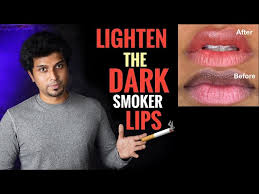 how to lighten dark smoker lips