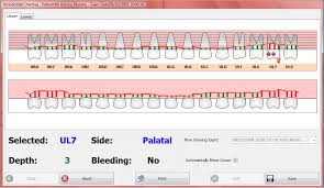 Perio Charting Shire Dental System Software For Uk Dental