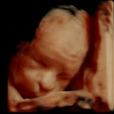 Ein 3d ultraschall kann während der gesamten schwangerschaft gemacht werden. 3d 4d Ultraschall Und Ultraschallbilder Ihres Babys Woman Health Frauenarzt Gynakologie 1010 Wien