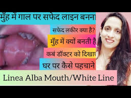 white line in mouth lenia alba mouth
