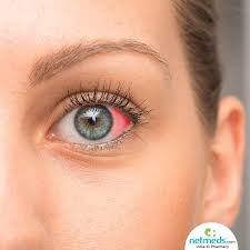 red spot on eye causes symptoms and