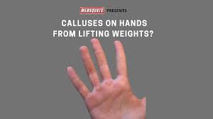 how to stop calluses on hands from gym