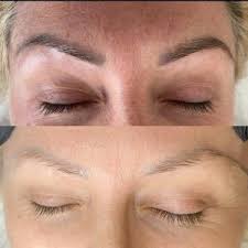 eyebrow tattoo microblading removal