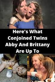 They have one body, share a pair of limbs, with two heads, two pairs of eyes, two necks, with separate vital organs such as two hearts, three kidneys, two spines joined. They Ve Spent 28 Years Conjoined Now Abby And Brittany Want To Share What S Next For Them Conjoined Twins Oprah Winfrey Show Gym Workout Tips