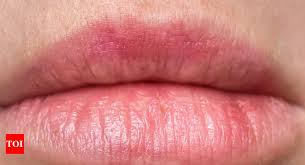 10 home remes to fix discolored lips