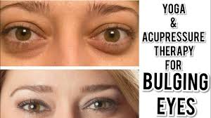 eye exercises accupressure therapy