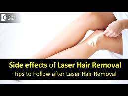 side effects after laser hair removal