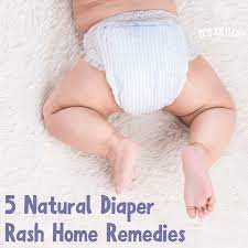 5 diaper rash home remes you need to