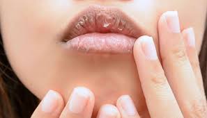 Misalnya, bila anda perokok aktif, bibir mungkin akan lebih gelap dari orang yang. Jangan Cuek 5 Masalah Di Bibir Ini Tunjukkan Kondisi Kesehatanmu Cantik Tempo Co