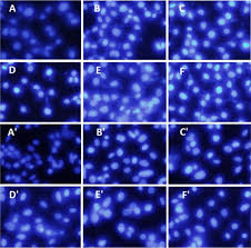 Results From The Hoechst 33258 Staining For Mgc 803 Cells