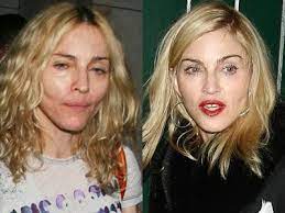 An madonnas (53) zeigefreudigkeit hat sich in den letzten 30 jahren kaum etwas geändert. Madonna Celebs Without Makeup Celebrity Surgery Celebrity Plastic Surgery
