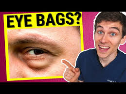 get rid of under eye bags