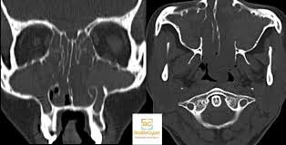 Also, see if you ca. Radiology Cases Quiz Spotters Set 34 Radiogyan Com
