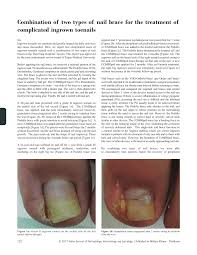 treatment of complicated ingrown toenails