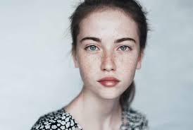 freckles removal singapore treatments