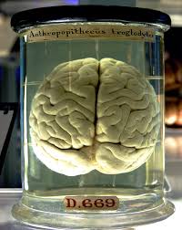 Brain Wikipedia