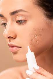 what is the best primer for acne scars