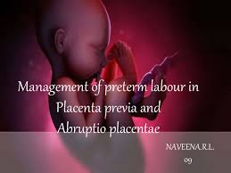 It is a condition seen in only advanced stages of pregnancy. Management Of Placenta Previa