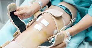 knee replacement infection treatment