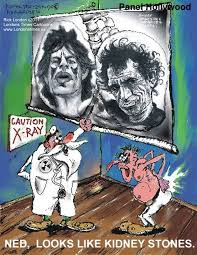 Analysis demonstrated 70% calcium oxalate monohydrate and 30% calcium phosphate. You Ve Got Rolling Stones By Londons Times Cartoons C2011 Rick London Syndication