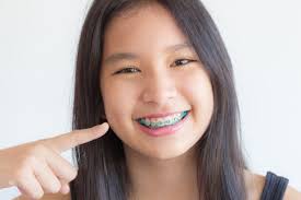 I don't think getting invisible braces are different from getting normal braces and braces does not hurt when you are getting them but when you got them on for a few hours or so it will kinda. An Orthodontist Answers Do Teeth Hurt After Braces Are Removed Bruce Orthodontics Rhinelander Wi