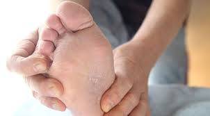 Let's learn more information on itchy hands no rash and home. Potential Causes Of Itchy Feet Superior Foot Ankle Care Center