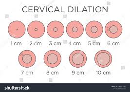 Cervical Dilation Medical Illustration Chart Centimeters