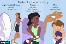 causes and treatments for itching