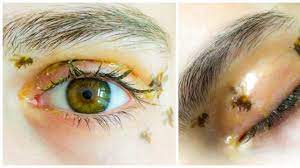 makeup artist put bees on her eyes