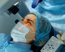 lasik eye surgery optical center