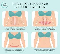 tummy tuck new jersey the r group