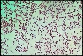 #listeria#monocytogenes#microbiology#virulencefactor#bacteriologyif you like ❤ this video please subscribe to med bees if you have any query or suggestion. Antibiotic Susceptibility Pattern Of Listeria Spp Isolated From Cattle Farm Environment In Bangladesh Sciencedirect