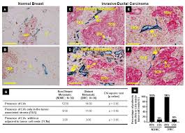 tumor microenvironment