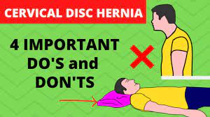 cervical herniated disc exercises to