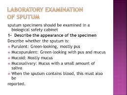 Sputum Test May Not Hold Key To Tb Eradicationsan Antonio