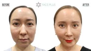 eyes face plus clinic korea