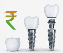 full dental implants treatment cost in